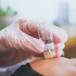 Unlocking Radiant Skin: The Gold Stamp Facial